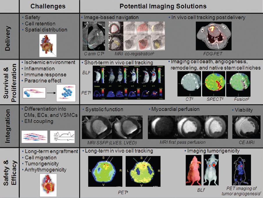 Imaging Cardiac Stem Cell