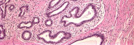 columnar epithelial cells uniform ovoid to