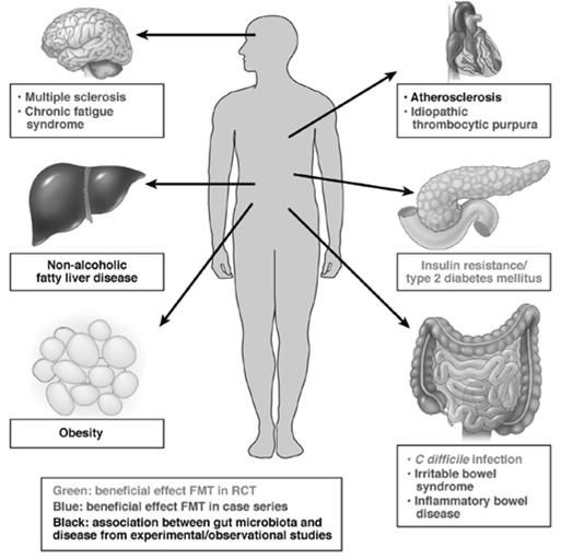 Potential Applications of FMT Conditions with Potential Links to Imbalances in the Microbiome Other non-gi disorders Obesity Asthma GVHD in bone marrow transplant