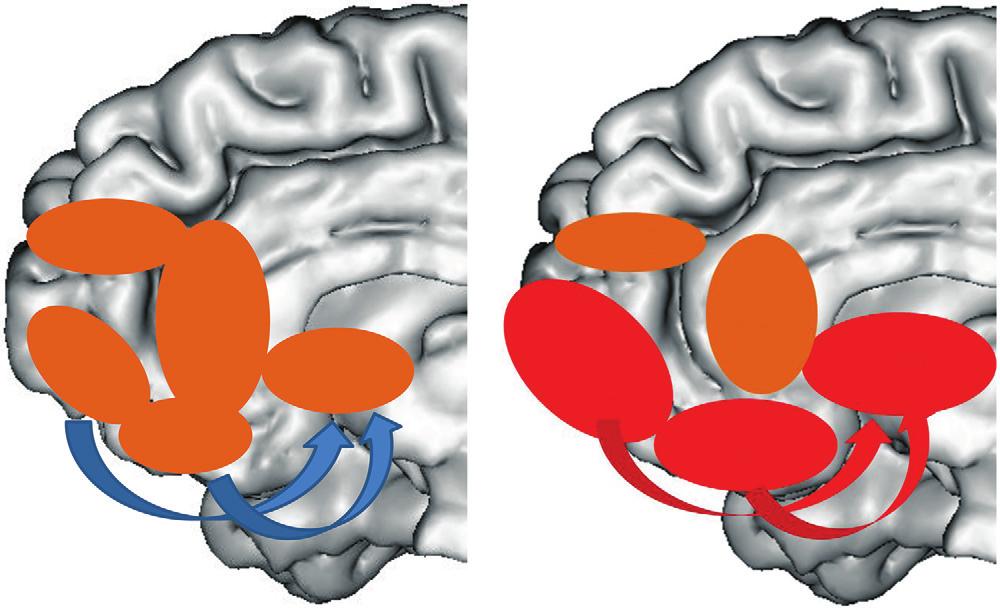 PHILLIPS AND SWARTZ FIGURE 2. Reward-Processing Neural Circuitry a A. Healthy B.