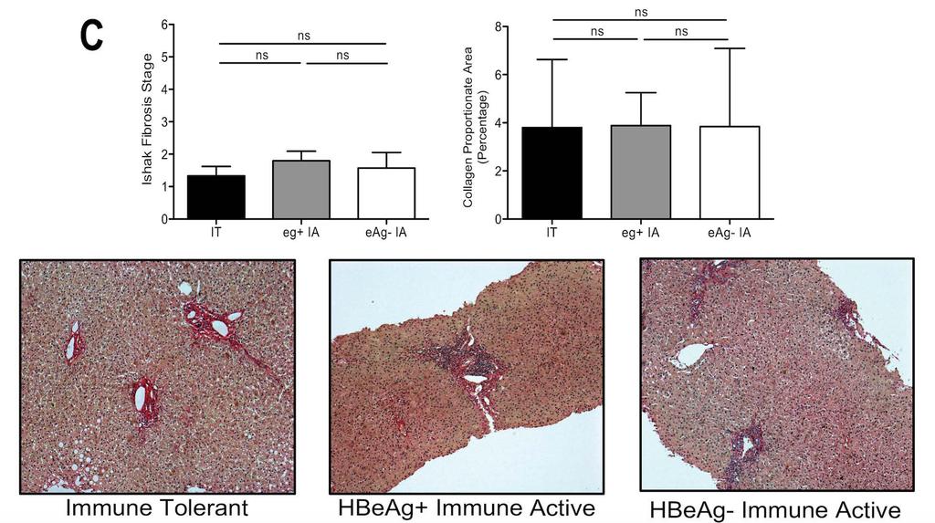 Evidence of liver damage in the immune tolerant
