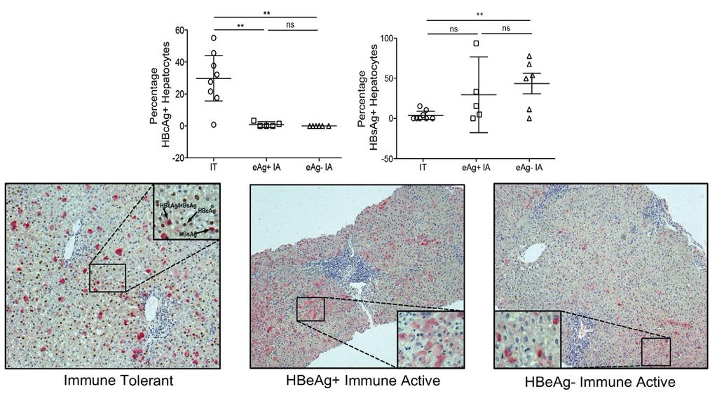 Nuclear core positive hepatocytes differentiate immune