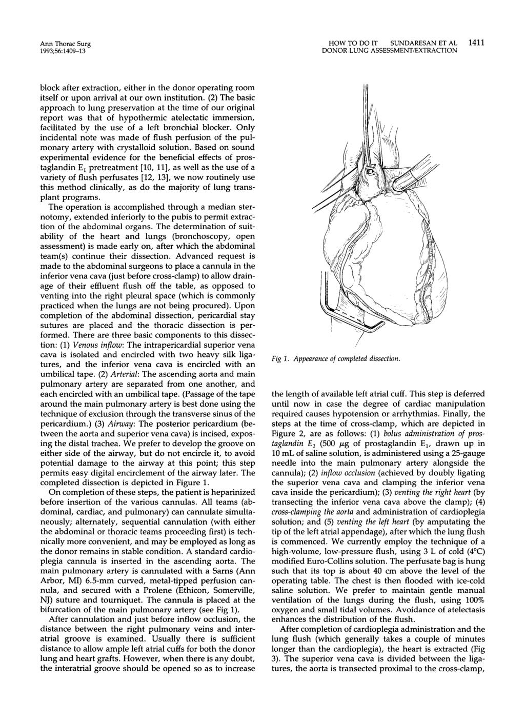 Ann Thorac Surg 1993;56: 1409-13 HOW TO DO IT SUNDARESAN ET AL 1411 DONOR LUNG ASSESSMENTiEXTRACTION block after extraction, either in the donor operating room itself or upon arrival at our own