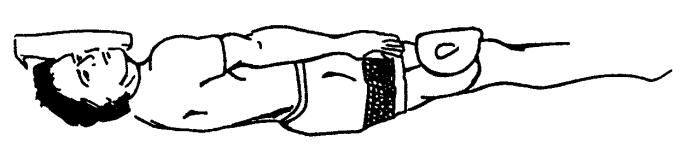 DAILY EXERCISES AND POSITIONING POSITIONING IN BED: Keep your residual limb close to your other leg and flat on the bed. Do not prop it on pillows/blankets.