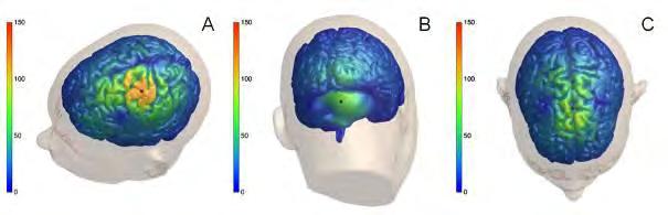 (A) The electric field distribution on the cortical surface for stimulation over left hemispheric M1, (B) right lateral
