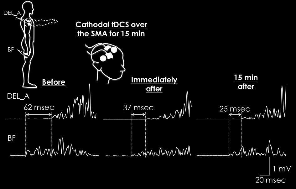 representative subject before, immediately after, and 15 min after cathodal tdcs