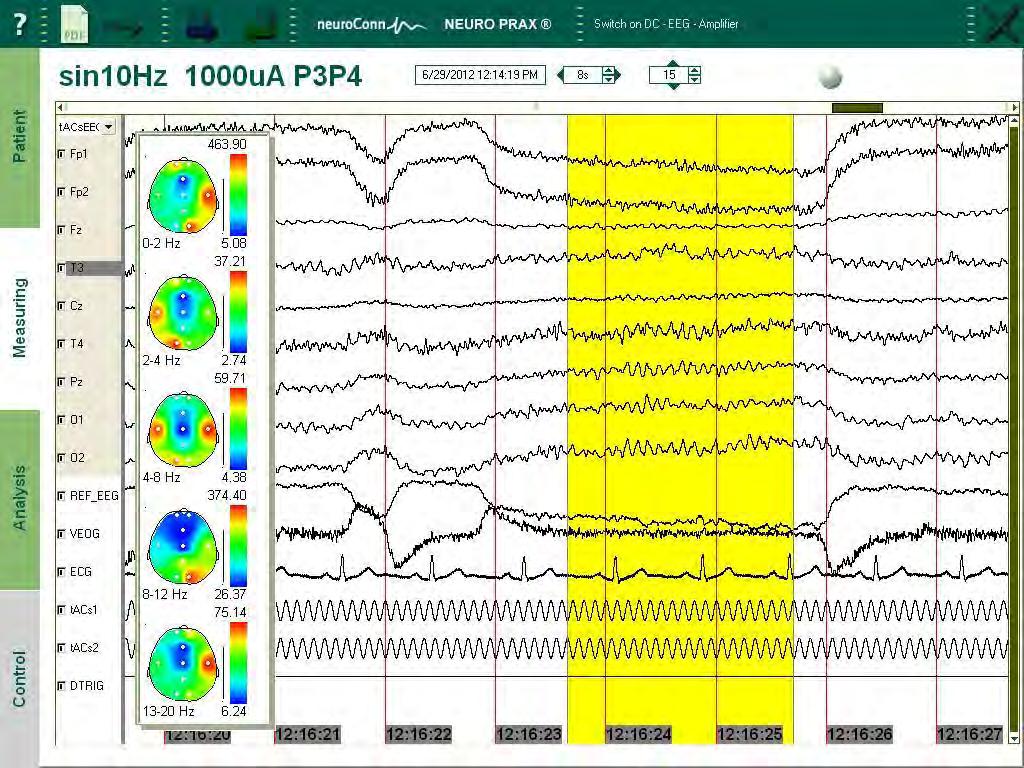 Figure 2: Online corrected EEG signals during eyes-closed condition