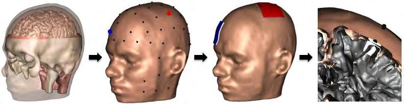 Figure 1: Setup of this study. Figure 2: Example of results for M1 stimulation. All electrode locations are condensed into one direction (as if viewed from the top of the head).