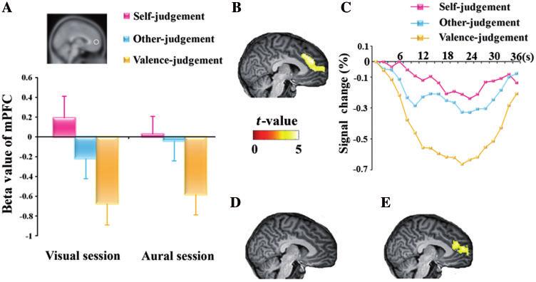 Neural representation of self-concept Brain 2011: 134; 235 246 239 in the brain regions that engaged more strongly in self-referential processing of visually than aurally delivered stimuli in sighted