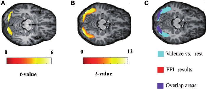 240 Brain 2011: 134; 235 246 Y. Ma and S. Han Figure 3 Results of psychophysiological interaction (PPI) analysis in Experiment 1.