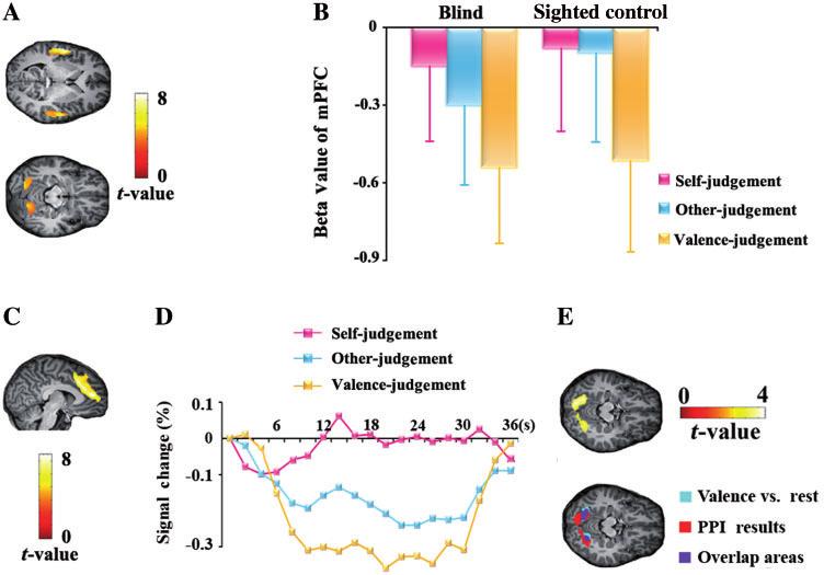 Neural representation of self-concept Brain 2011: 134; 235 246 241 these brain regions were differentially involved in processing visually and aurally presented stimuli, we conducted an interaction