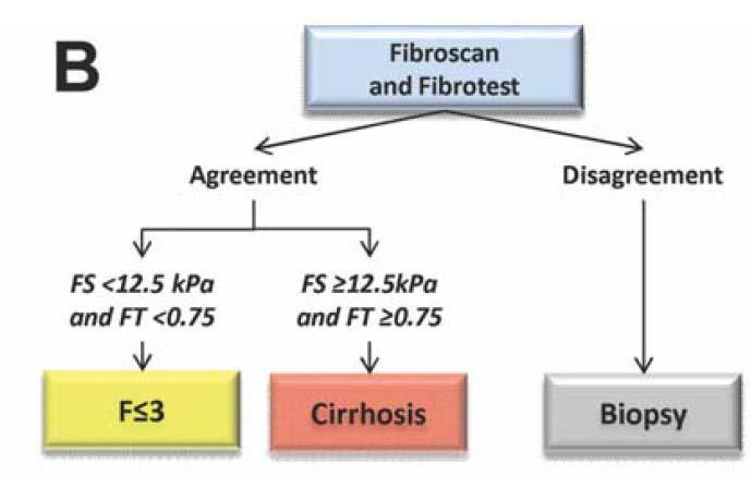Elastography can be combined with serum fibrosis tests Bordeaux algorithm for cirrhosis Attribute accuracy 94.