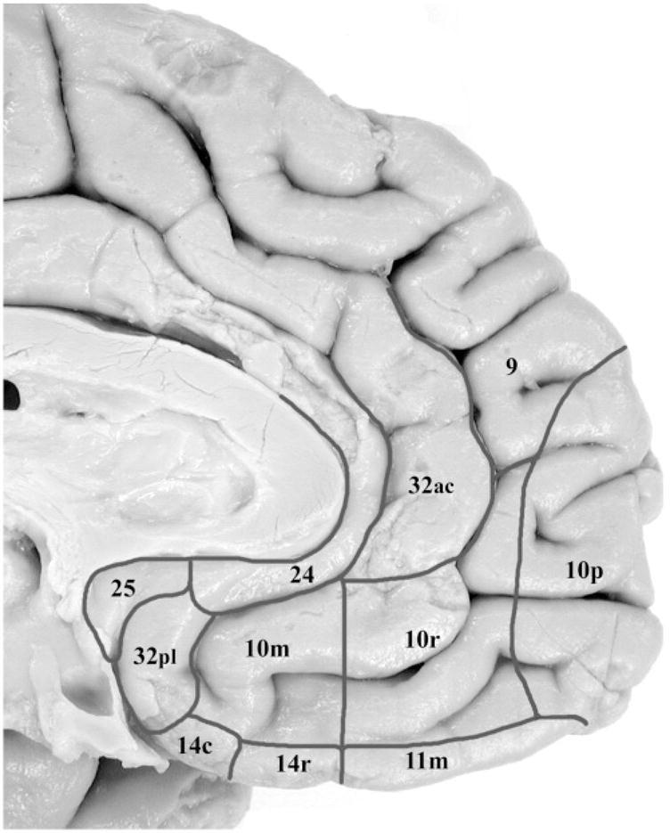 Neuroimaging data suggest that the peri-callosal tissue of the ventro-medial prefrontal cortex known as the anterior