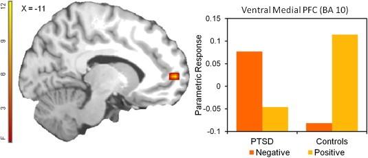 Group valence interaction. There was differential sensitivity in the ventral medial prefrontal cortex (PFC) in PTSD vs.