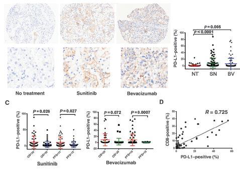 Resistance to antiangiogenic therapy is associated with an Immunosuppresive tumor