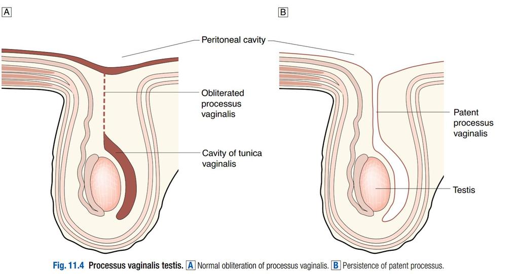 The inguinal ligament b. The External spermatic fascia of the spermatic cord c. Near its meadial attachment onto the pupic tubircle it divides to form the superficial or the deep inguinal ring. 5.