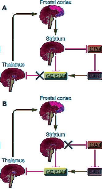 Figure 1 Model for the cortico-striato-thalamo-cortical circuit dysfunction in individuals with OCD.