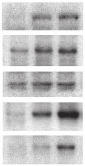 Anti-GRB-2 IP Flag- -WT/PYK2/ -Y171/PYK2/ -WT// -Y171// -WT/PYK2/ -Y171/PYK2/ -WT// -Y171// 12 1 2 3 4 5 6 7 8 Flag-PYK2/ -WT/Y171F Figure 4 LFA-1, and PYK2 phosphorylate restricted site Y-171 on.