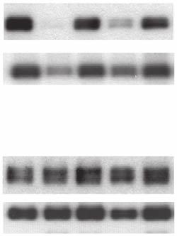 Jurkat cells were ligated with anti-cd3 or anti-lfa-1/cd3 for 2 2 min, followed by membrane preparation and blotting for py-171-, py-191-, py-132- and with anti- (n ¼ 3).