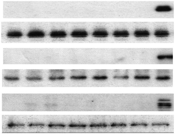 phosphorylated by (Fig. 4c, lanes 1, 3 and 5, respectively). However, Y-171F and Y-171/191-F mutants showed a markedly reduced signal (Fig. 4c, lanes 2, 4).