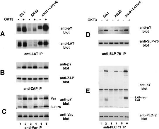 Reconstitution of a LAT-deficient T cell line 947 Fig. 3. CD3ε expression and CD69 up-regulation in Jurkat E6.1, ANJ3 and ANJ3 reconstituted with wild-type LAT.