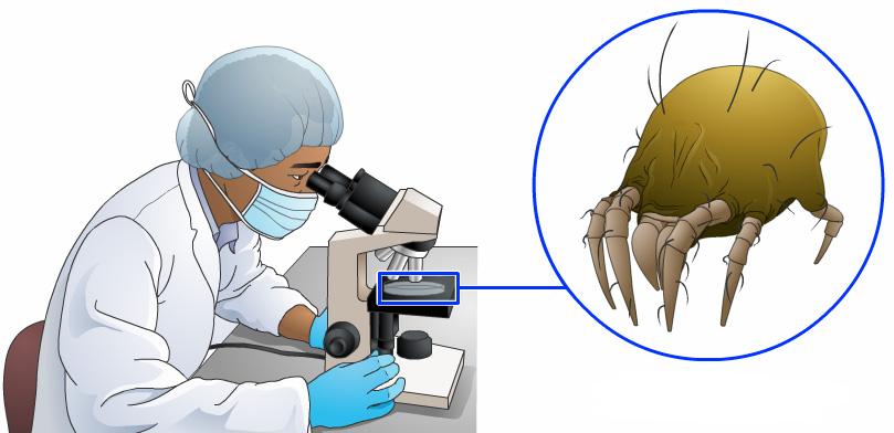 Dust Mite Allergy Introduction Of the many components in house dust to which people may be allergic, the most important is the house dust mite.