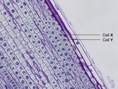 Q5. The photograph shows some cells in the root of an onion plant. By UAF Center for Distance Education [CC BY 2.0], via Flickr (a) Cells X and Y have just been produced by cell division.