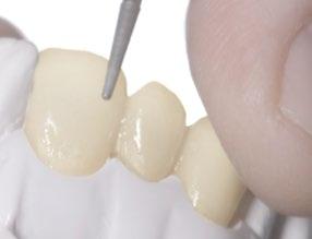 step. Paint a fine line of Crème on the incisal