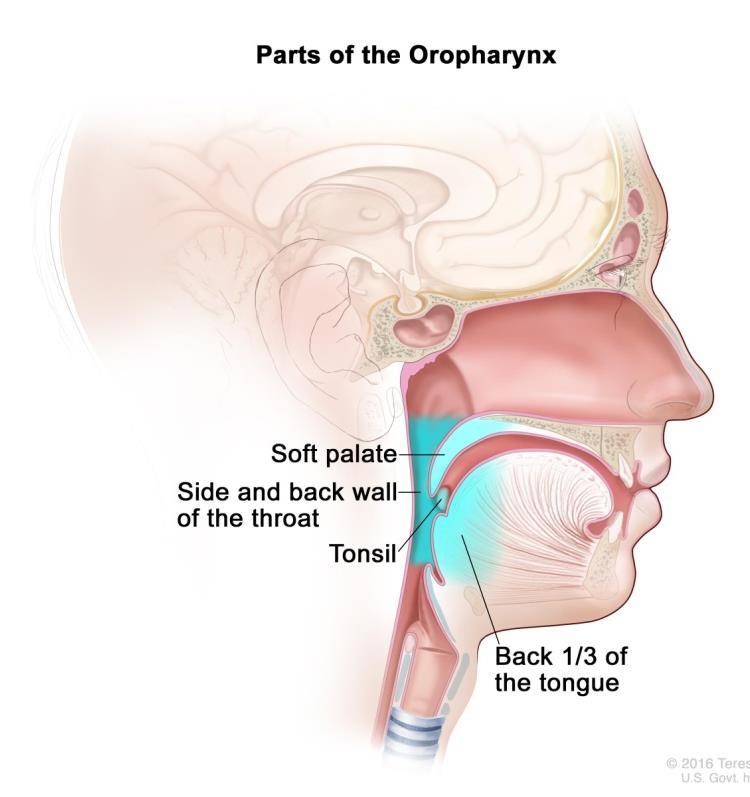 Head and neck cancers Oral cavity cancers, associated with tobacco and alcohol, are decreasing Cancers of the tongue, base of the tongue & other oropharyngeal sites are increasing These are