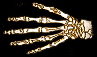 THE APPENDICULAR The Hand The carpals, or wrist of the hand, is made of eight small bones in two