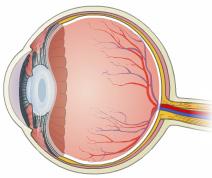 LASIK Introduction LASIK surgery is a procedure that improves vision and can decrease or eliminate the need for eyeglasses or contact lenses.