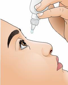 Before the procedure, the eye is numbed with special anesthetic eye drops. LASIK surgery is not painful. The cornea is held in place with a vacuum device.
