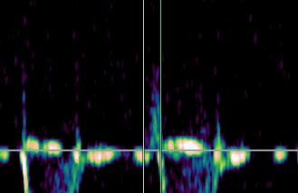 Aortic flow recording (marmoset) Pulmonary flow recording (marmoset) Measurements Vmax,