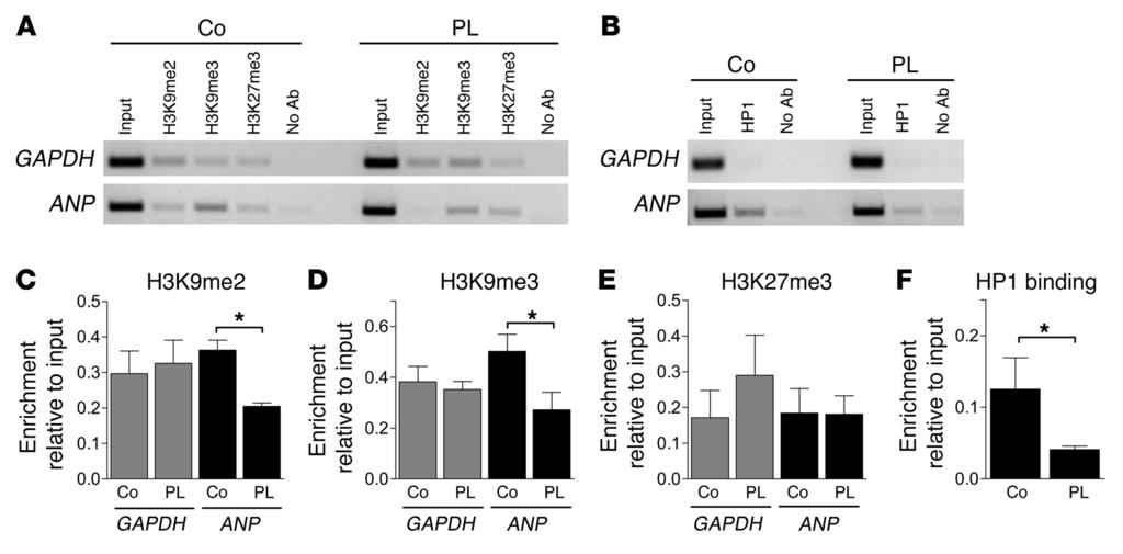 Figure 8 Elevated preload induces H3K9 demethylation in and HP1 dissociation from the promoter region of ANP.
