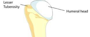 9. humerus (landmarks) - Greater tuberosity bicipital groove Greater tuberosity Lesser tuberosity The bicipital groove is also