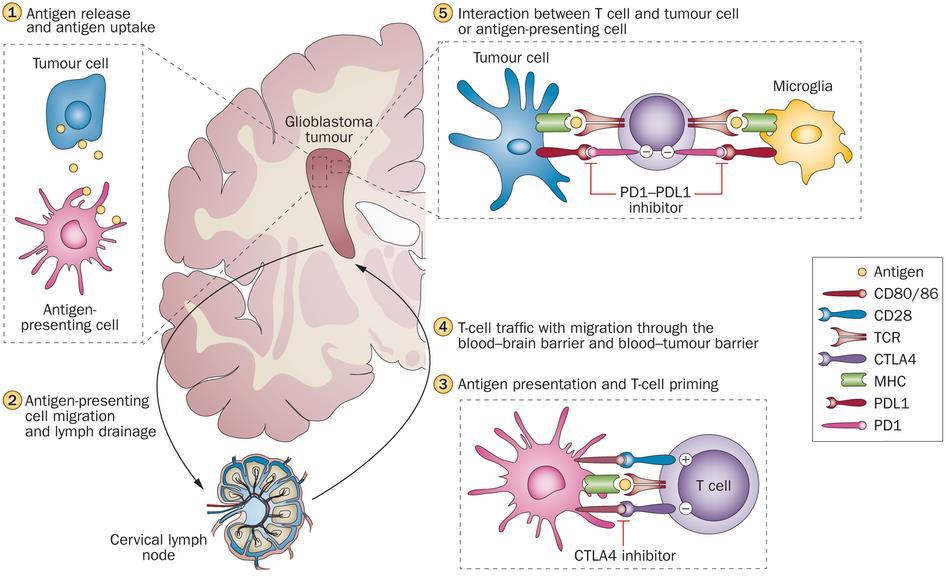 Immune Cycle in Glioblastoma Interplay of Immuno-Oncology Assets