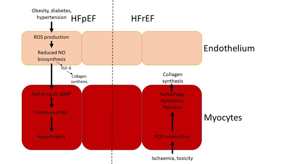 Fig 3: putative pathological mechanisms: differences between HFpEF and HFrEF Energy Depletion In obesity and diabetes, there is a reduction in glucose uptake by myocytes, with this loss of fuel