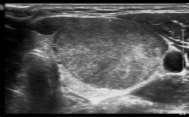 ultrasound image in Fig. 5A.
