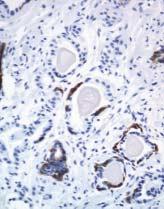 A basal cell layer is not apparent in these acini, and nuclei are slightly enlarged.