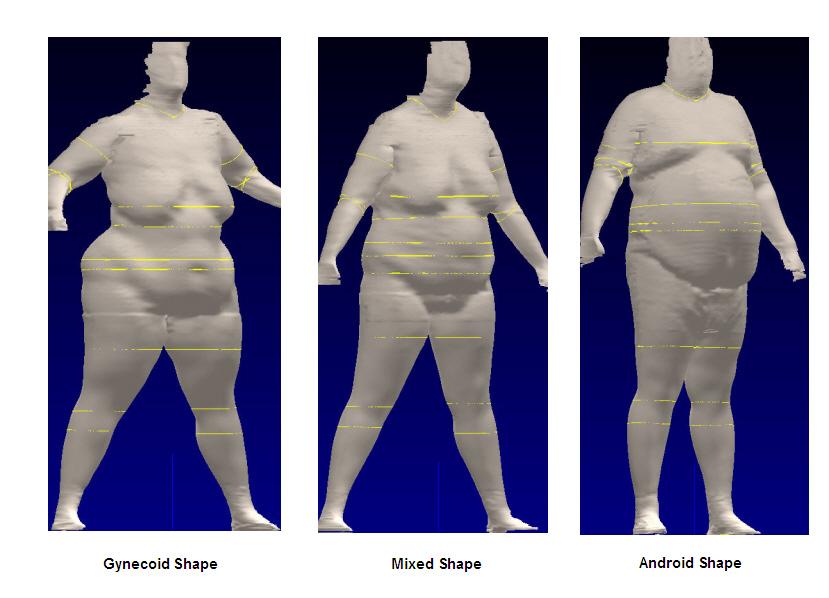Figure 1. Typical Shapes for Morbidly Obese Subjects To determine the shape of the morbidly obese subject, the torso was used as a proxy for the overall body.