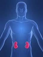 Kidney (renal) problems Can affect up to 40% of patients. Causes of kidney problems include: light chain build-up in the kidney tubules causing blockages.