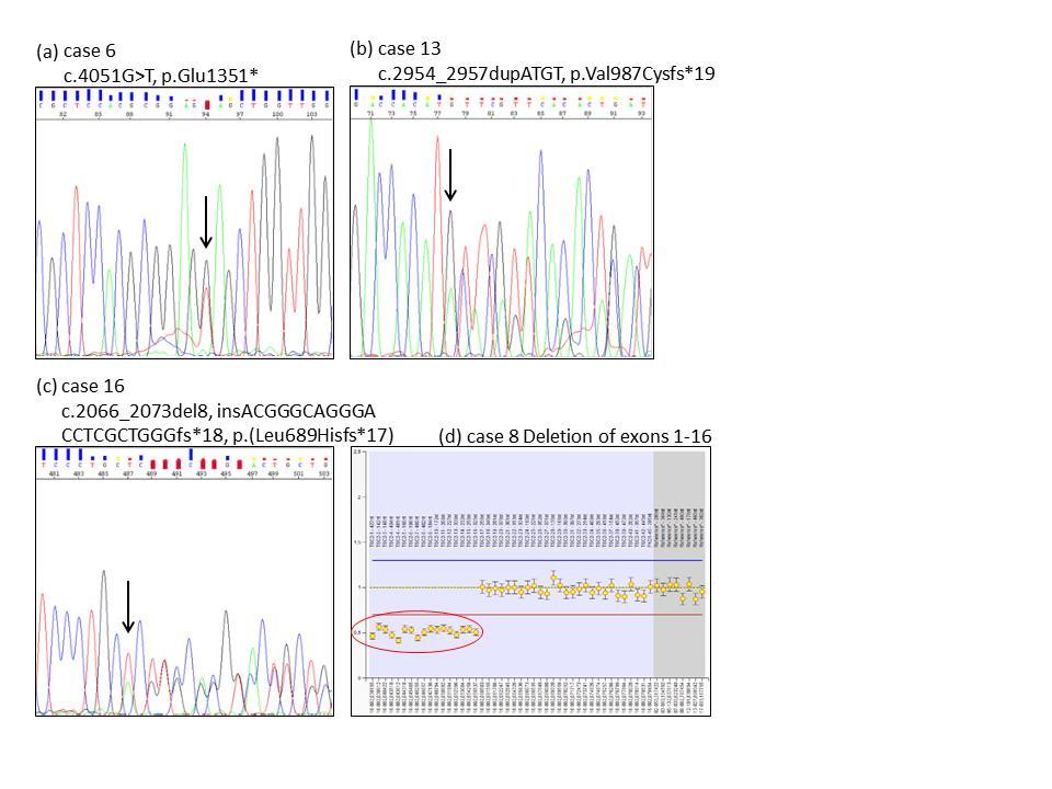 Figure 3. Sequencing chromatograms of 4 novel mutations in the TSC1 gene.