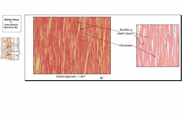 Lots of elastic fibers Fibroblasts in spaces between fibers Provides stretch and