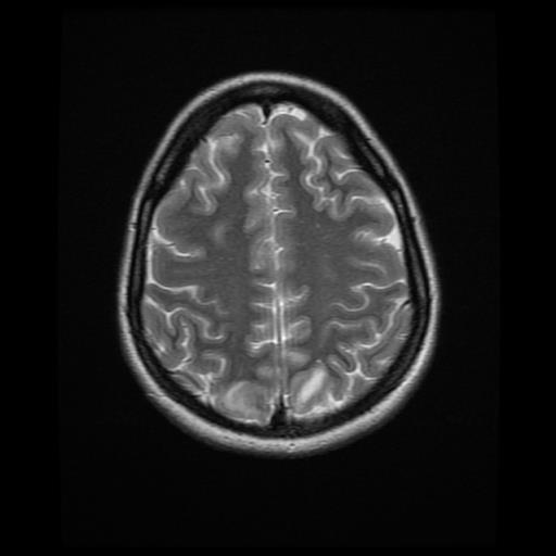 Case #1 Imaging MRI brain