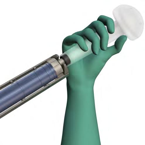 Screw the Optivac cartridge delivery port directly to the distal threaded opening on the mold (Figure 5).