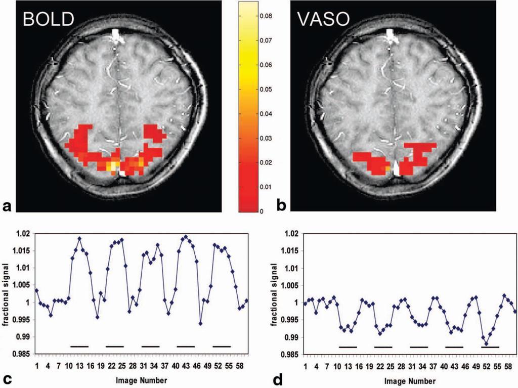 fmri Based on Changes in VASO 265 FIG. 1. Principle of VASO-fMRI. a: MRI experiment timing.