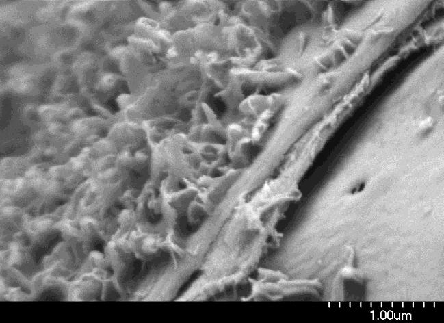 Epidermal cells on leaf in waxy layer in leaf
