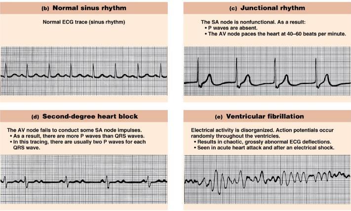 Electrocardiogram (EKG): record of heart activity The hearts electrical signals can be measured and recorded digitally to produce an image called an Electrocardiogram (ECG or EKG).