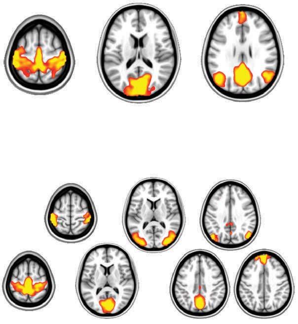 At the network level, a map of the default mode network (middle image, yellow; note cross-network anticorrelations in blue; global signal regressed) can be generated with a seed in the left lateral