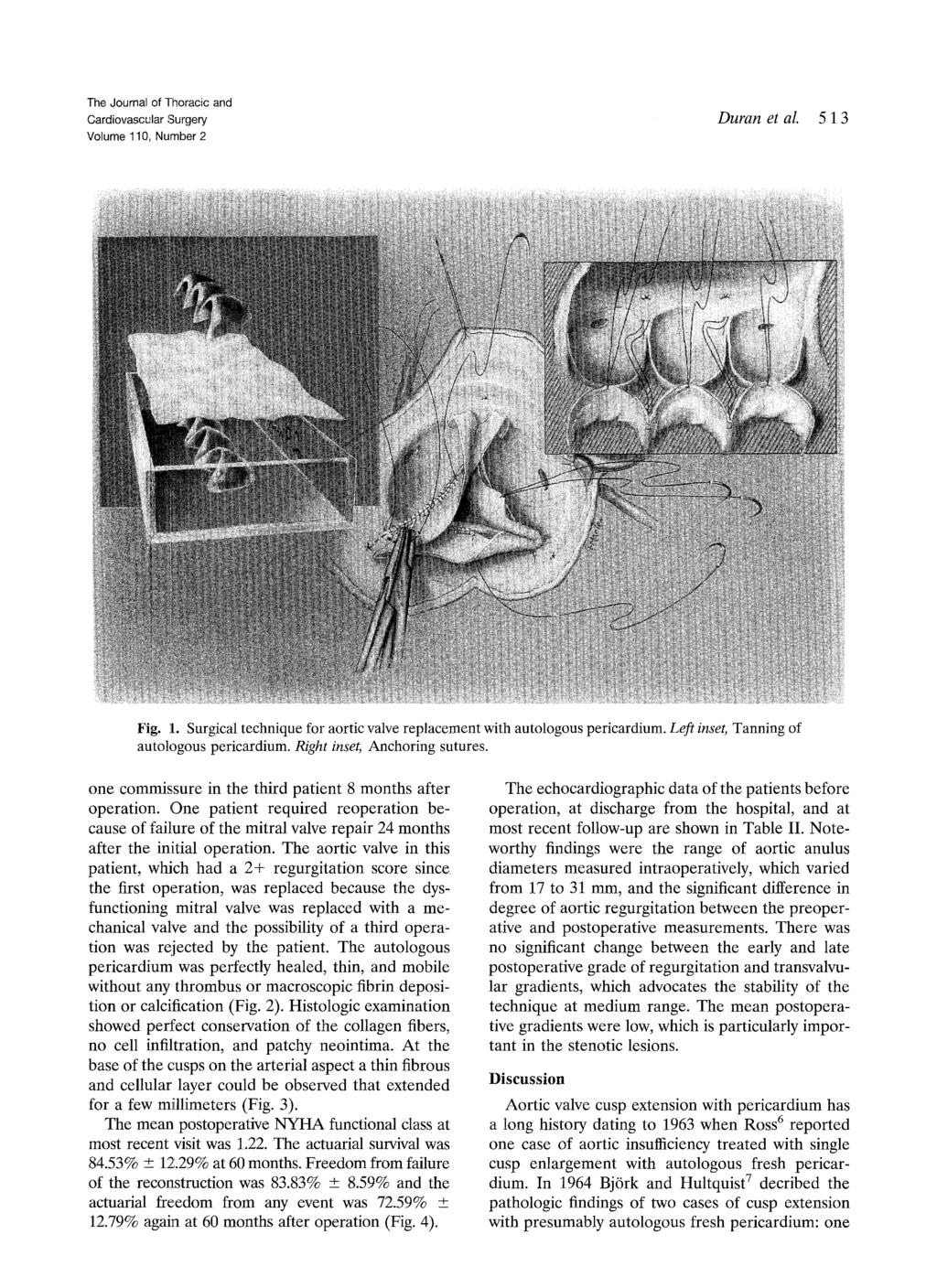 Volume 110, Number 2 Duran et ai. 5 13 Fig. 1. Surgical technique for aortic valve replacement with autologous pericardium. Left inset, Tanning of autologous pericardium.